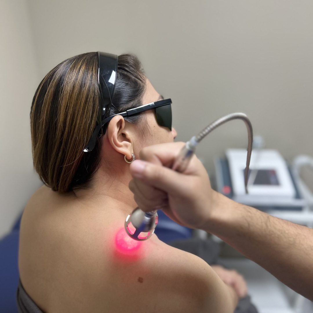LASER THERAPY FOR UPPER BACK PAIN