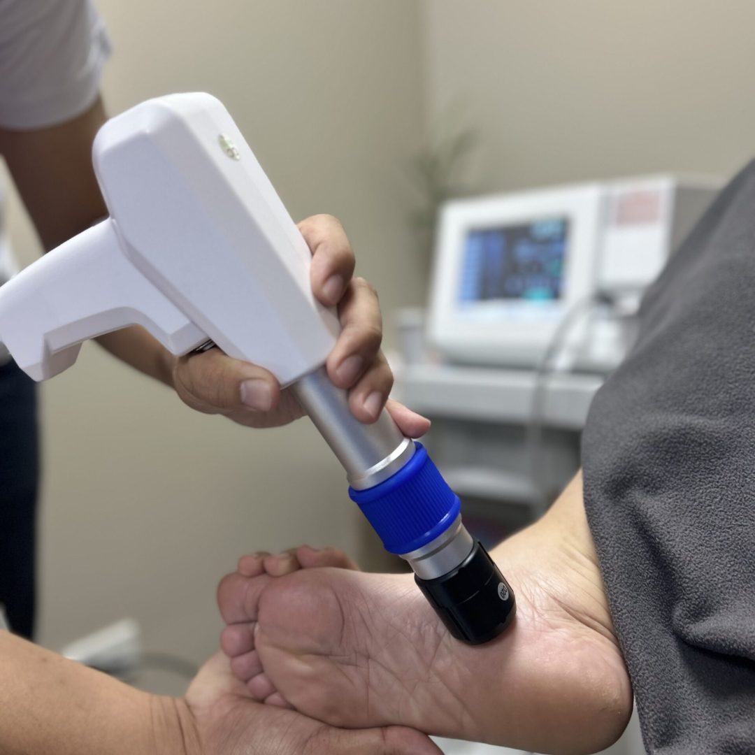 SHOCKWAVE THERAPY FOR FOOT PAIN